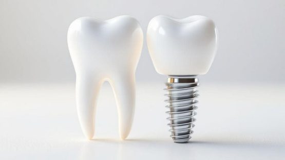 قیمت ایمپلنت اصفهان | بهترین ایمپلنت اصفهان | ایمپلنت دندان سوئیسی در اصفهان | موفقیت ایمپلنت دندان