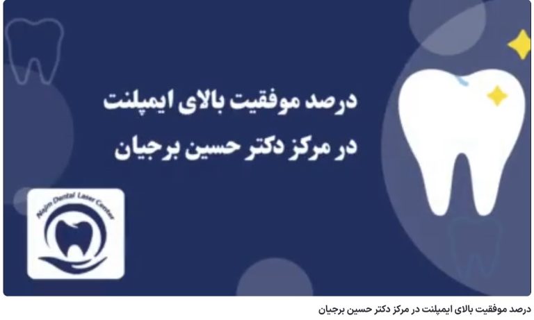 درصد موفقیت بالای ایمپلنت در مرکز دکتر حسین برجیان دکتر حسین برجیان،بهترین متخصص ایمپلنت اصفهان،تلفن تماس: 09138690321