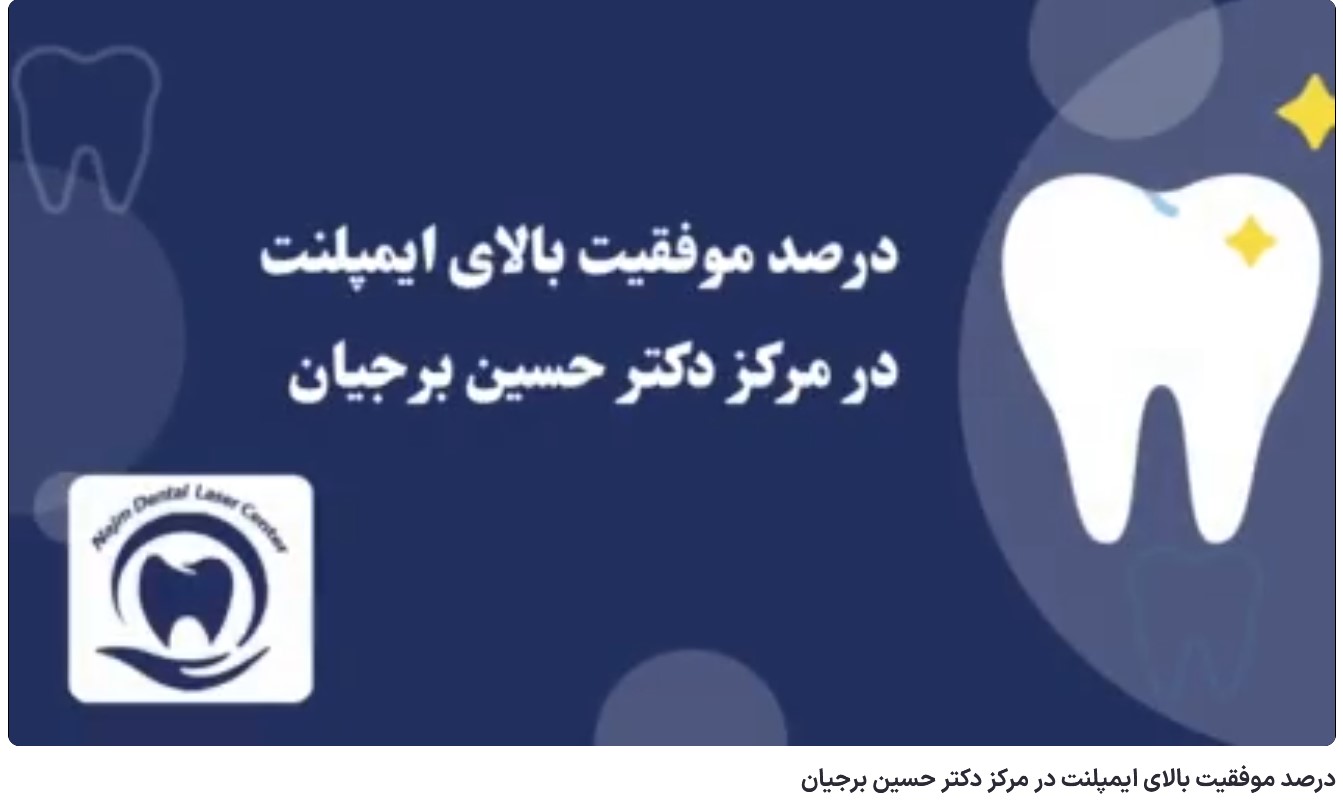 درصد موفقیت بالای ایمپلنت در مرکز دکتر حسین برجیان دکتر حسین برجیان،بهترین متخصص ایمپلنت اصفهان،تلفن تماس: 09138690321