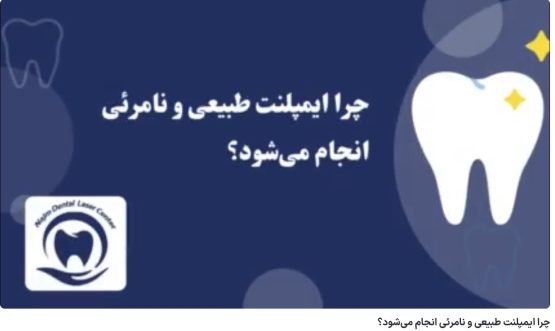 چرا ایمپلنت طبیعی و نامرئی انجام می‌شود؟ دکتر حسین برجیان،بهترین متخصص ایمپلنت اصفهان،تلفن تماس: 09138690321