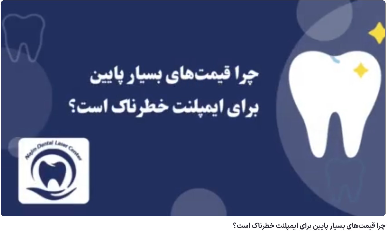 چرا قیمتهای بسیار پایین برای ایمپلنت خطرناک است؟ دکتر حسین برجیان،بهترین متخصص ایمپلنت اصفهان،تلفن تماس: 09138690321