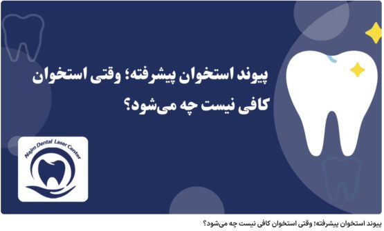 ویدئو آپارات پیوند استخوان پیشرفته؛ وقتی استخوان کافی نیست چه می‌شود؟