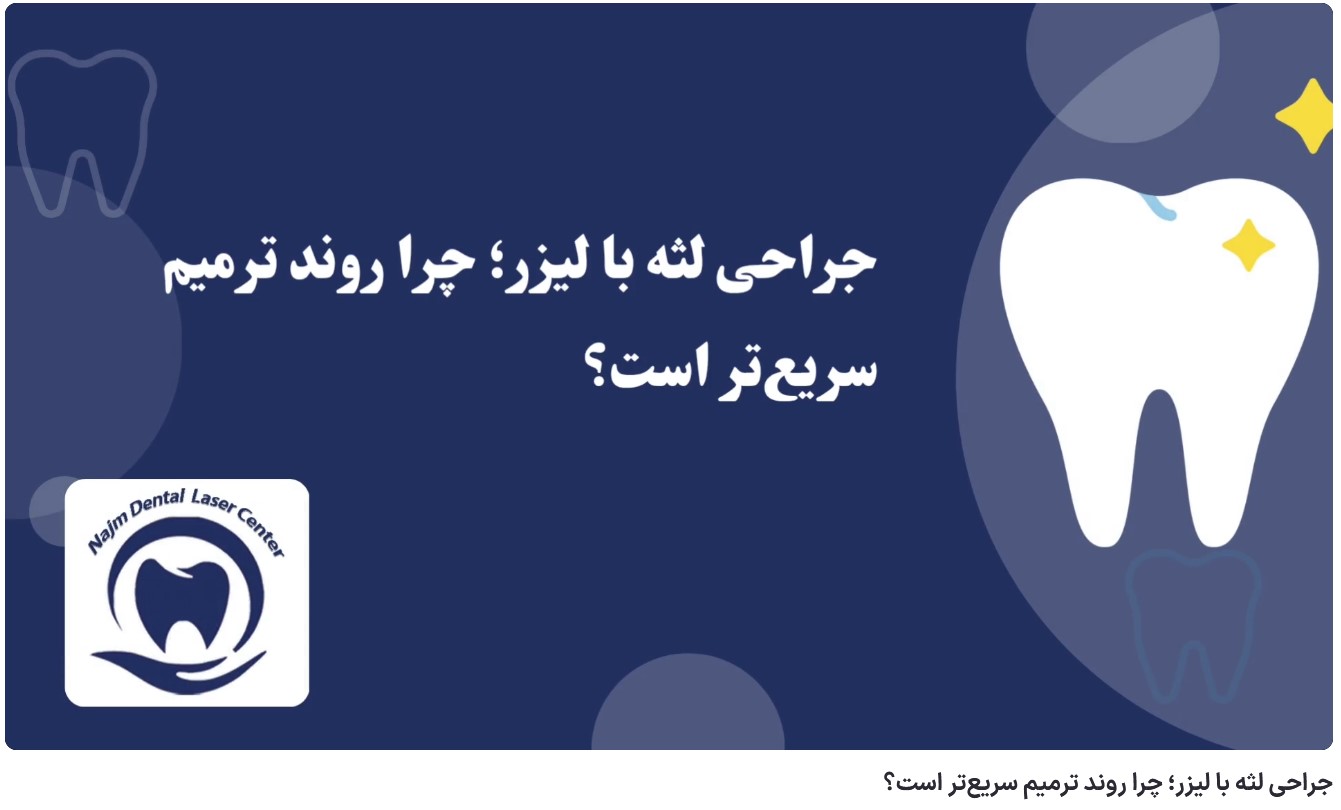ویدئو آپارات جراحی لثه با لیزر؛ چرا روند ترمیم سریع‌تر است؟