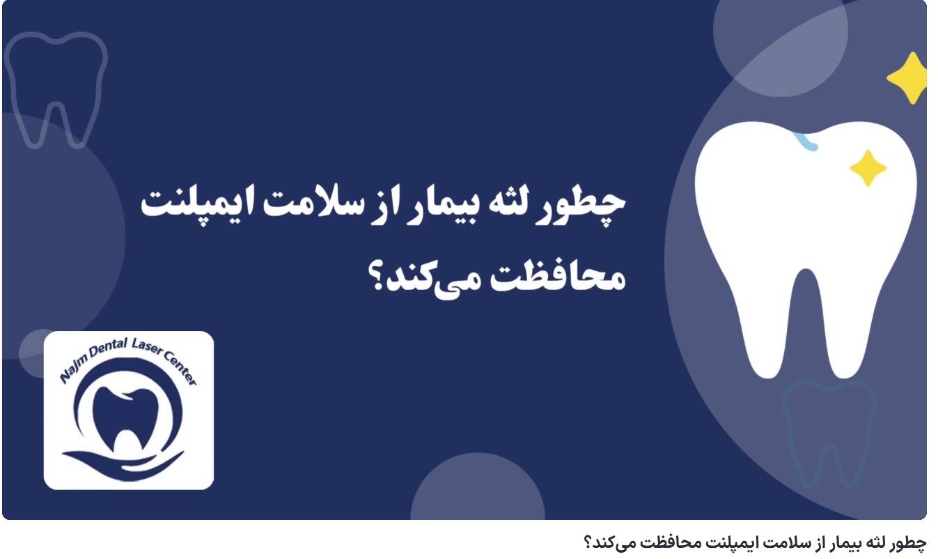 ویدئو آپارات چطور لثه بیمار از سلامت ایمپلنت محافظت میکند؟