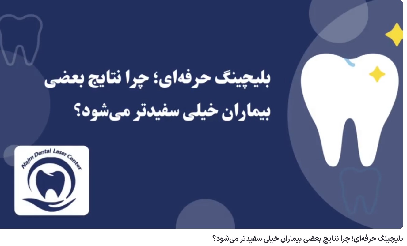 ویدئو آپارات بلیچینگ حرفه‌ای؛ چرا نتایج بعضی بیماران خیلی سفیدتر می‌شود؟