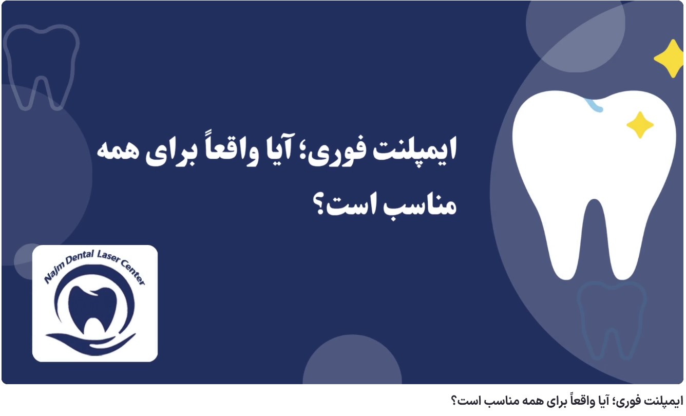 ویدئو آپارات ایمپلنت فوری؛ آیا واقعاً برای همه مناسب است؟