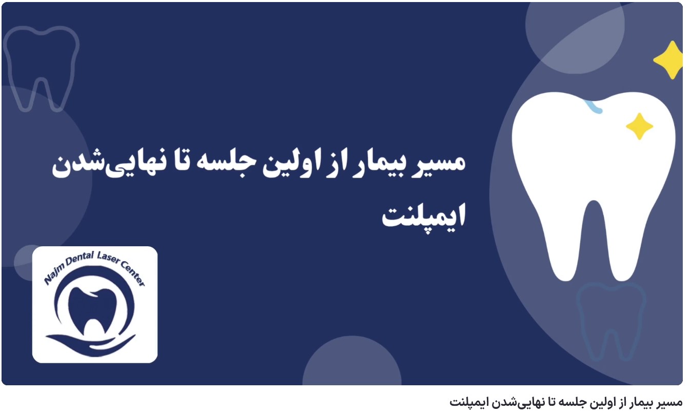 ویدئو آپارات مسیر بیمار از اولین جلسه تا نهایی‌شدن ایمپلنت